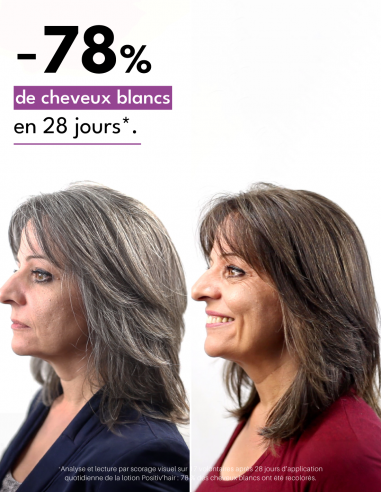 Positiv'hair Lotion Ultra+