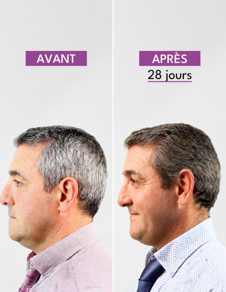 Positiv'hair Lotion Ultra+ - Cheveux brun foncé